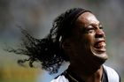 Ronaldinho si nechal srovnat předkus