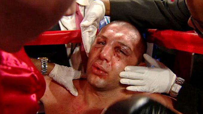 Zbitý Magomed Abdusalamov v průběhu zápasu s Mikem Perezem ve svém rohu.