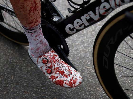 3. etapa Tour de France 2021: Krev na noze Stevena Kruijswijka.