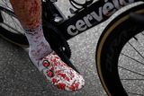 K tomu samému pádu se nachomýtl také Rogličův týmový kolega z Jumbo-Visma, Steven Kruijswijk. Rozříznutý prst Nizozemce spravily stehy, nicméně v cíli ukázal boty, ponožky i kolo od krve.