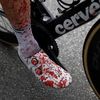 3. etapa Tour de France 2021: Krev na noze Stevena Kruijswijka