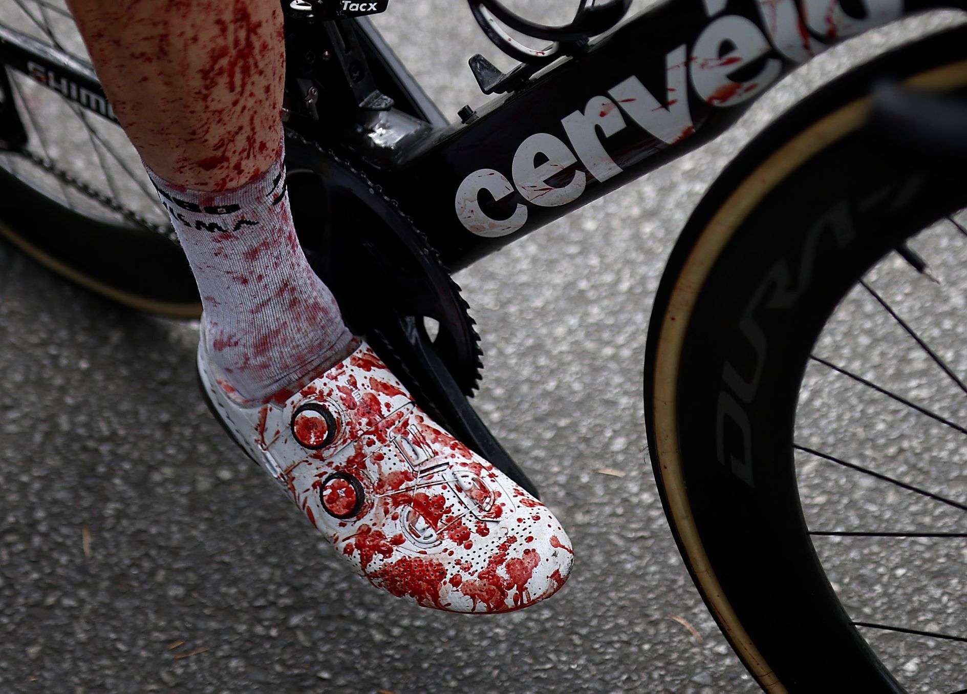 3. etapa Tour de France 2021: Krev na noze Stevena Kruijswijka