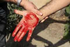 Země EU zvažují,že pustí zraněné Íránce na své ambasády