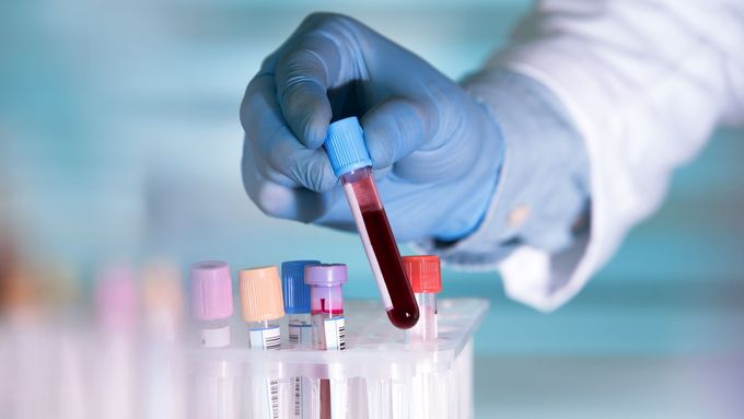 Umělá krev by mohla jednou provždy vyřešit nejpalčivější problém moderní medicíny – nedostatek krve.
