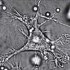 Dendritická buňka