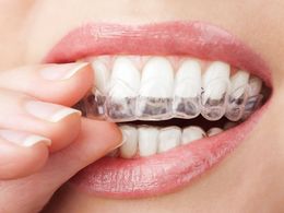 Zuby ochrání noční hlídač: Co jste nevěděli o chrupu?
