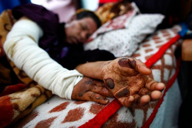 Pacientka v Gaze