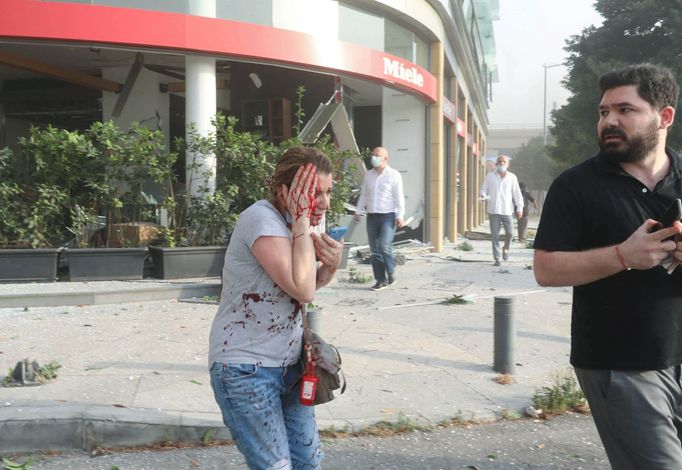 Zraněná žena po výbuchu v Bejrútu.