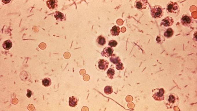 Mikroskopický snímek bakterií úplavice.