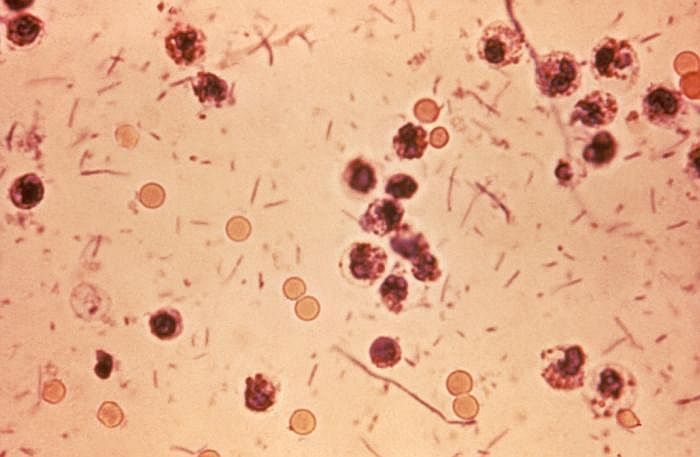 Mikroskopický snímek bakterií úplavice