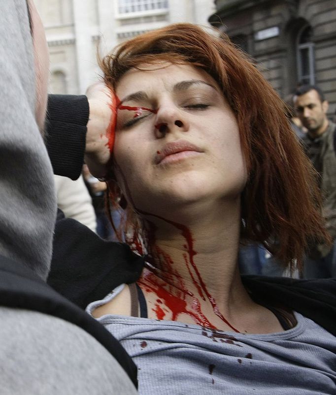 Lidé odnášejí do bezpečí zraněnou demonstrantku. Během protestů došlo k několika krvavým srážkám s policií. Zraněné hlásily obě strany.