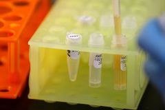 Máme dobrou zprávu, vakcína reaguje, tvrdí britští vědci o látce proti koronaviru