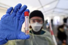 Jaký je stav "závodu o vakcínu" proti koronaviru? Vědci jsou opatrně optimističtí