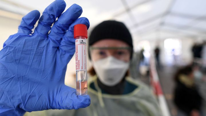 Jaký je stav "závodu o vakcínu" proti koronaviru? Vědci jsou opatrně optimističtí