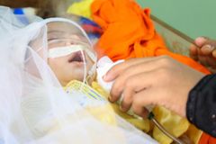 Nepoznaly nic jiného než válku. Miliony dětí v Jemenu trpí podvýživou, zemí se šíří epidemie cholery