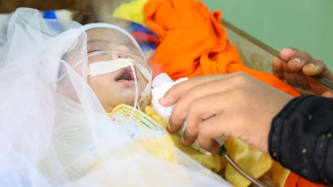 V Jemenu se děti rodí často už silně podvyživené. Mnohé nepřežijí ani první měsíc.
