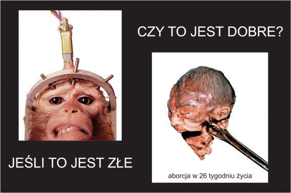 Vyber život - výstava - potrat