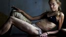 n this photo provided on Friday Feb. 10, 2012 by World Press Photo, the 1st prize Contemporary Issues Singles category of the 2012 World Press Photo contest by Brent Stirton, South Africa, Reportage by Getty Images for Kiev Independent, shows Maria, a drug addict and sex worker, in between clients in a room she rents in Kryvyi Rig, Ukraine. Maria injects drugs on a daily basis and sees many men every week but claims she remains HIV negative. She says she need the money to support herself, her drug habit and her nine-year-old daughter.