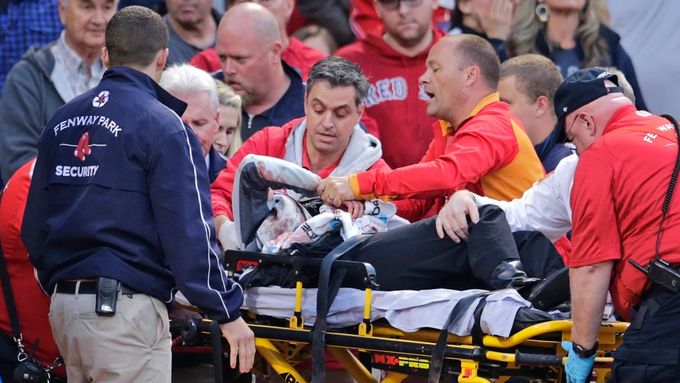Zraněná žena po zásahu kusem baseballové pálky.