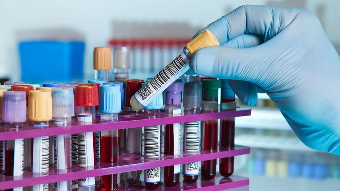 Krevní skupiny nejsou jen biologickou zajímavostí. Jsou živým důkazem evolučního přizpůsobení.