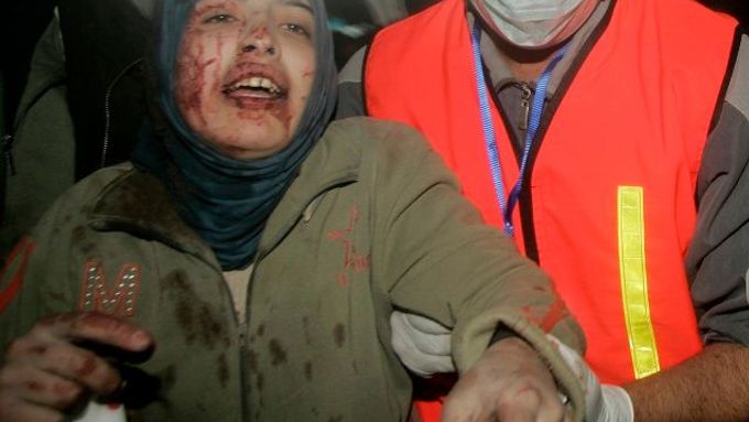 Zraněná Palestinka v nemocnici Al-Šífa v Gaze
