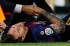 Barcelona se musí obejít bez Messiho, zlomil si ruku. Chybět bude i proti Realu