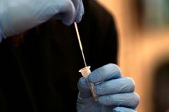 V neděli přibylo v Česku o třetinu víc případů koronaviru než před týdnem