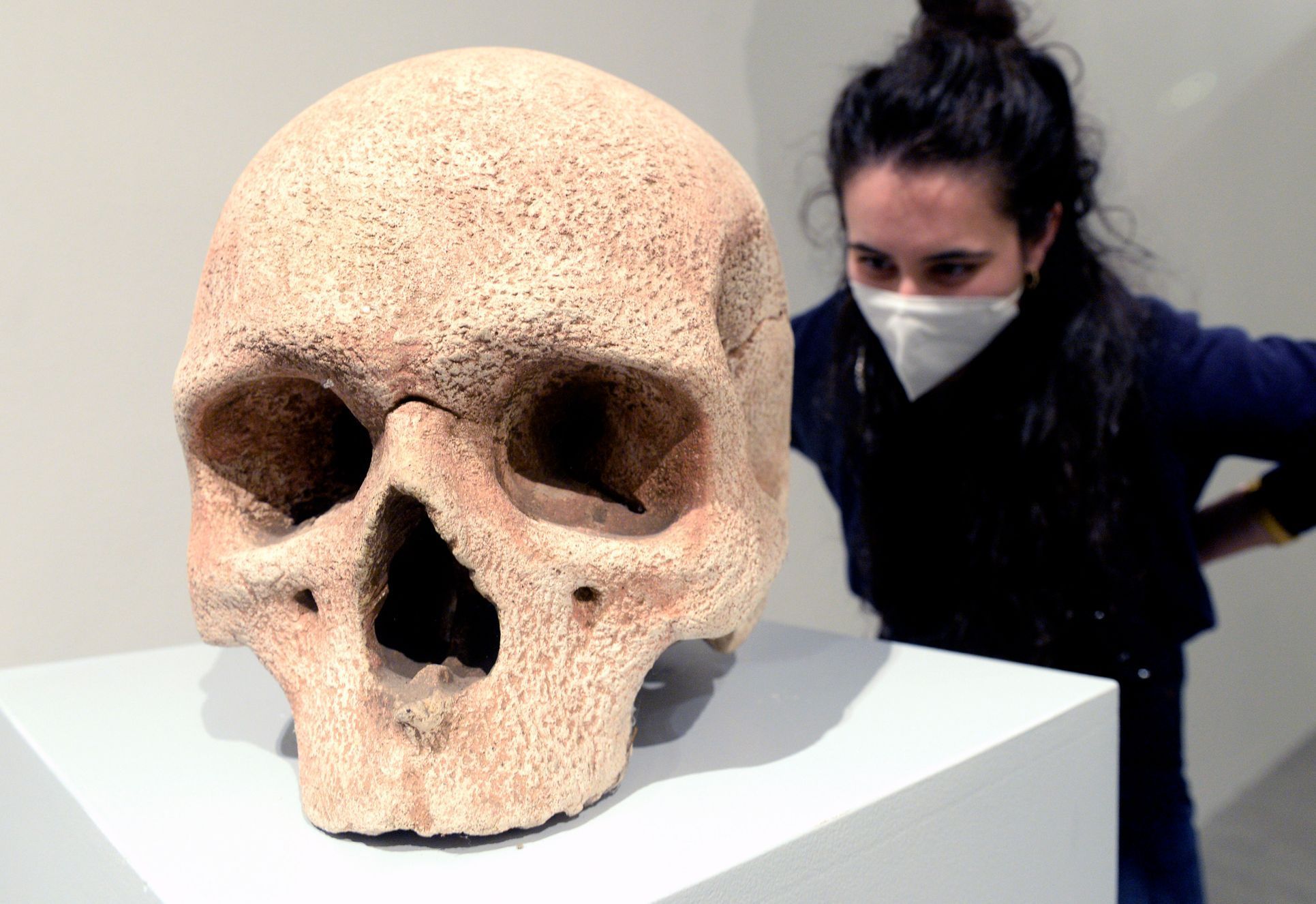 Josef Hnízdil: Calva