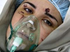 Noor al Samraová odpočívá v nemocnici na jihu Libanonu. Noor byla zraněna během izraelského leteckého útoku na město Súr.