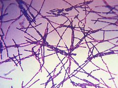Bacily anthraxu