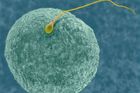Objev vědců: Spermiím škodí nadbytek ženských hormonů