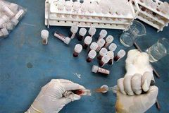 Nakazili děti virem HIV. Půjdou v Kazachstánu za mříže
