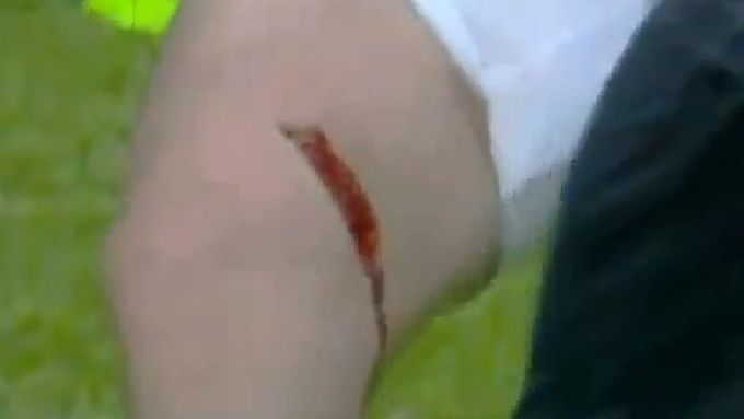 Hugo Rodallega z Fulhamu zranil po střele kolíky kopačky útočníka ManU Wayna Rooneyho