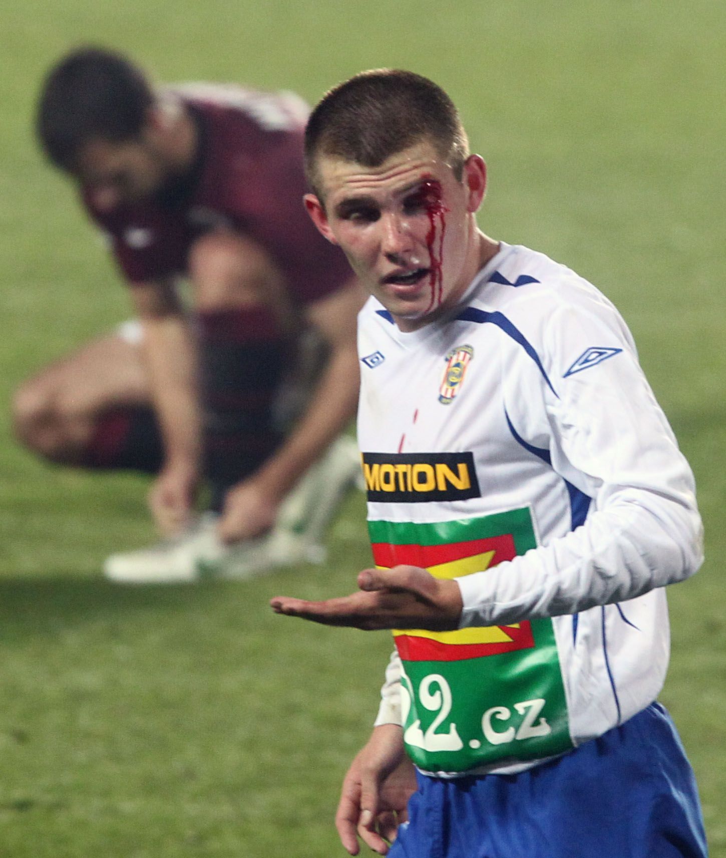 Fotbalista Brna Milan Lutonský se zranil v utkání proti Spartě během 14. kola Gambrinus ligy 2012/13.