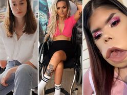 Světové beauty youtuberky s handicapem