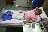 Paní Jaroslava (55) ví o své vrozené nemoci už 35 let. Před devíti měsíci jí ledviny selhaly definitivně. Dvakrát týdně chodí do nemocnice. Dnes je napojena na umělou ledvinu naposled.
