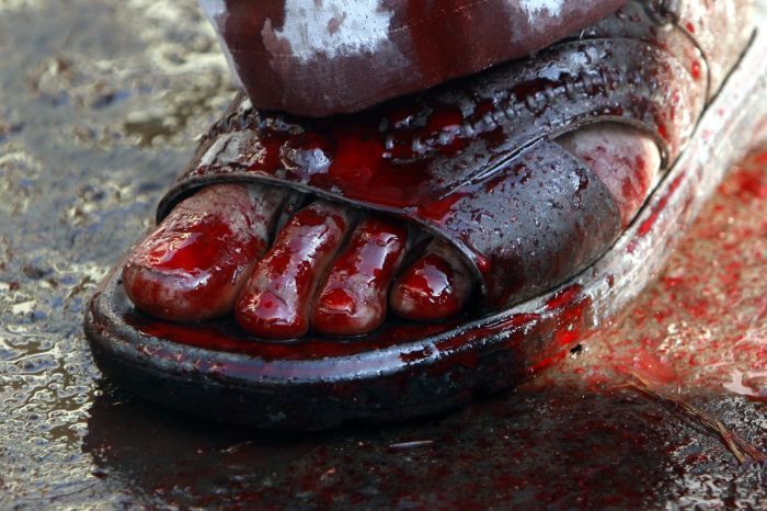Noha od krve