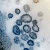 Fotografie koronaviru napadajícího buňky na snímcích z elektronkového mikroskopu, pořízené americkým Národním institutem pro alergie a infekční nemoci NIAID