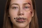 Rusky se fotí s krvavými jizvami. Chtějí prosadit zákon proti domácímu násilí