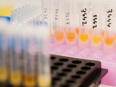 Expertní laboratoř v Lausanne, kde se testují vzorky odebrané sportovcům na zakázané látky. Na snímku vidíte ampule s močí.