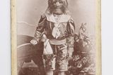 Na této vzácné archivní fotografii si můžete prohlédnout Stephana Bibrowského (1891-1932), kterému silná hypertrichóza vysloužila přezdívky "muž se lví tváří" či "Lionel". Díky cirkusovému nadání se Lionel stal umělcem známým po celém světě.
