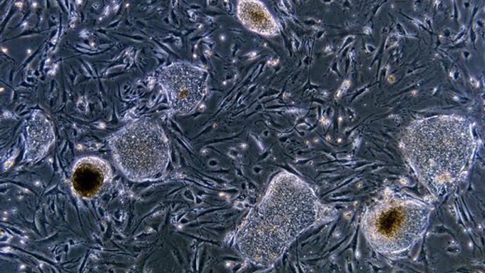 Mikroskopický snímek kmenových buněk z lidského embrya, jejichž využití slibuje převrat v medicíně.