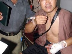 Číňan zraněný po útoku islámských radikálů. Jeho tři spolupracovníci střelbu nepřežili.