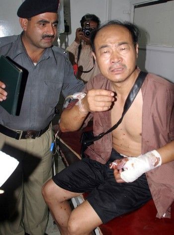 Zraněný Číňan v Pákistánu