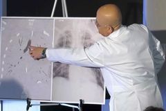 Mladík ukázal snímek zničených plic po kouření e-cigaret. Bez transplantace by zemřel
