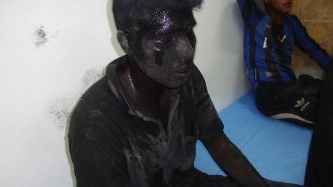 Zraněný muž pokrytý sazemi čeká po teroristickém útoku na ošetření