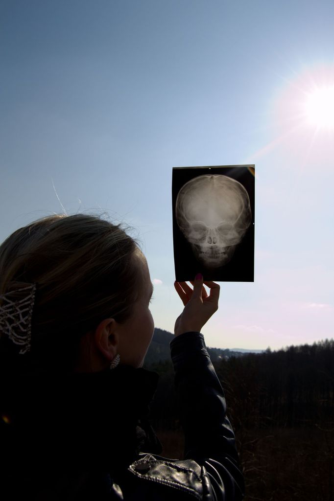 Povedená série fotografií zatmění od čtenáře Tomáše Kodydeka.