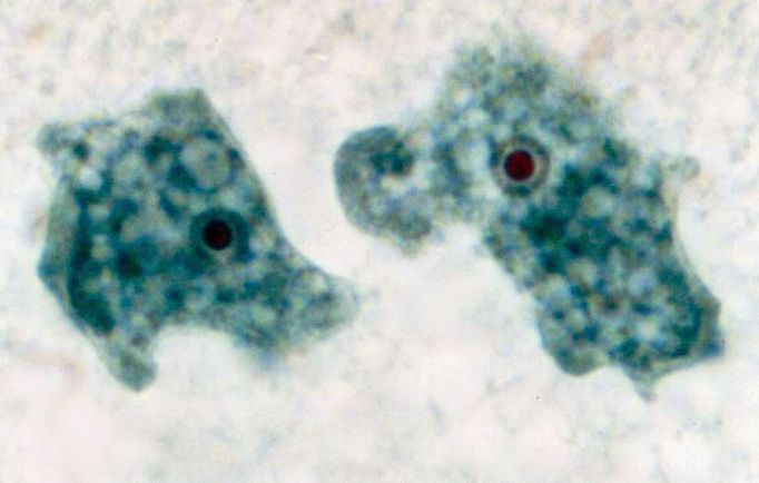 Kmen mikrobu Naegleria fowleri HB-1 v axenické kultuře. Mikroskopický snímek.