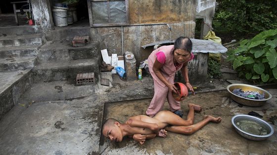 Foto: Agent Orange zabíjí i 40 let po konci vietnamské války