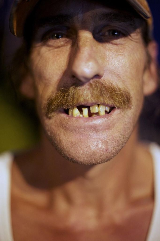 Joe Roberts, from Sutherland, Virginia, intending to have 10 teeth extracted, waits for his wristband number to be called at the Remote Area Medical (RAM) clinic in Wise, Virginia July 20, 2012. RAM clinics bring free medical, dental and vision care to uninsured and under-insured people across the country and abroad. The Wise clinic was the 647th RAM expedition since 1985 and drew 1700 patients from 14 states, organizers said. REUTERS/Mark Makela (UNITED STATES - Tags: HEALTH SOCIETY) Published: Čec. 24, 2012, 3:02 odp.